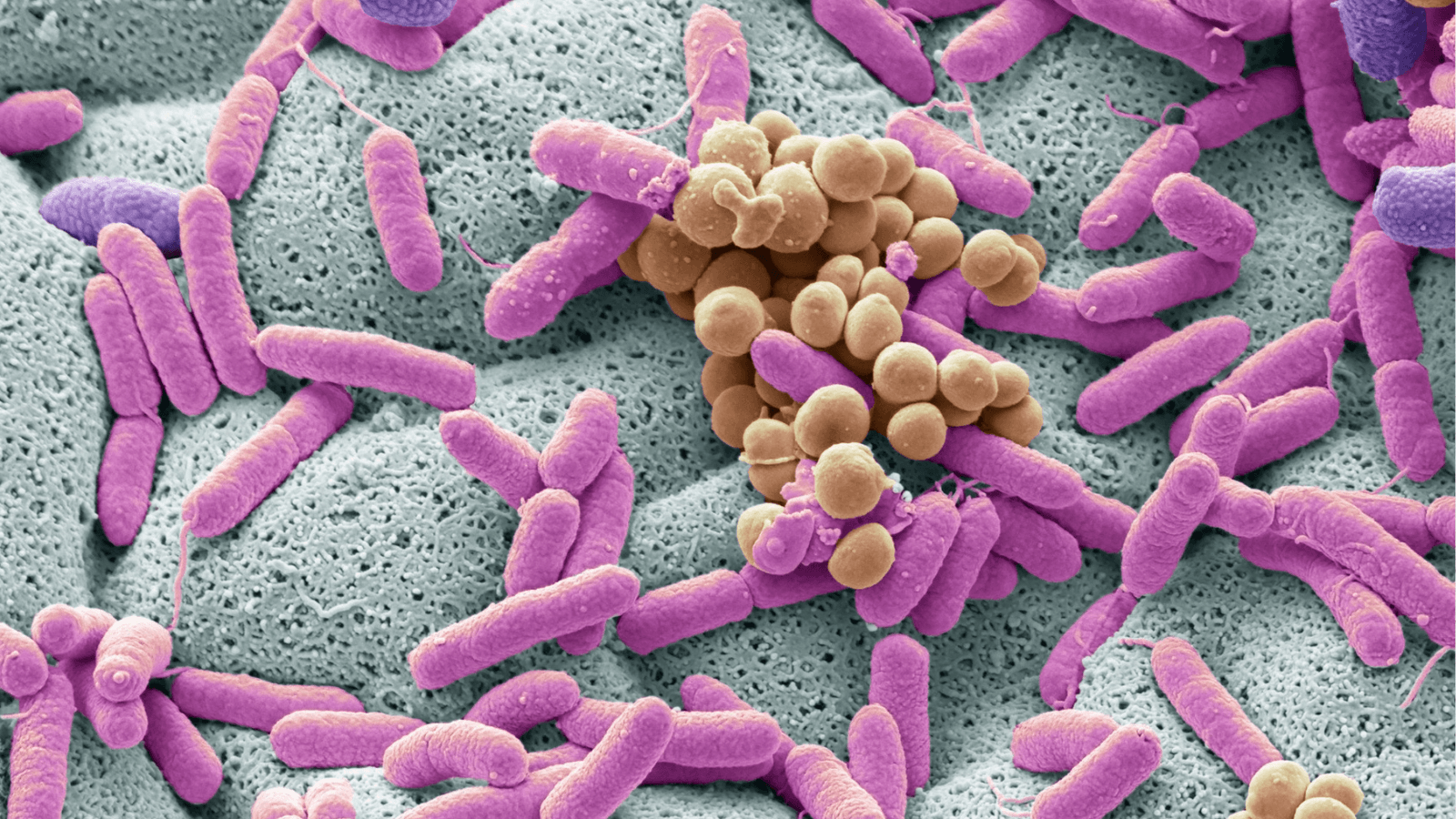 Cosa significa "microbiota-friendly" su un integratore o cosmetico: la guida al termine